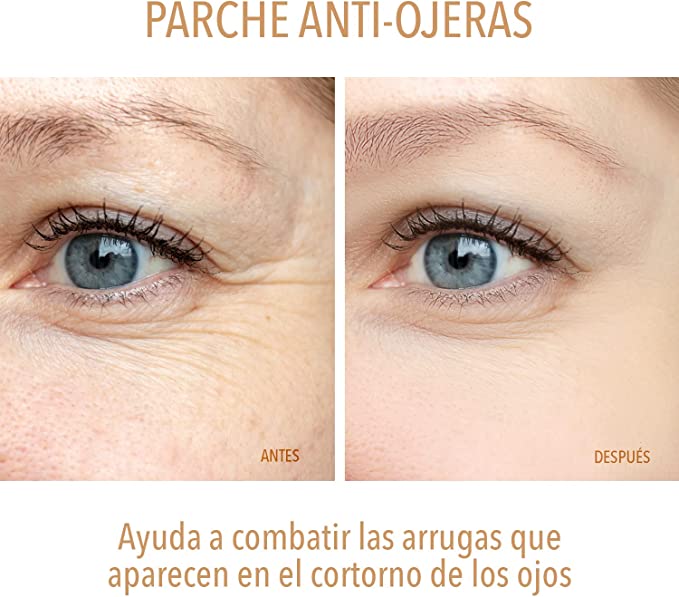 PARCHES ANTIOJERAS